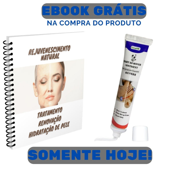 SomeVerrugas! - Creme de tratamento de verrugas + EBOOK GRÁTIS - Mania das CoisasSomeVerrugas! - Creme de tratamento de verrugas + EBOOK GRÁTISMania das Coisas